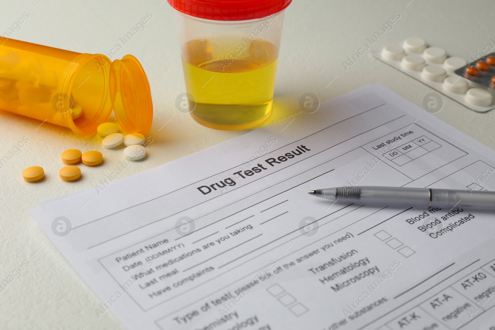 Photo of Drug test result form, container with urine sample and pills on light table