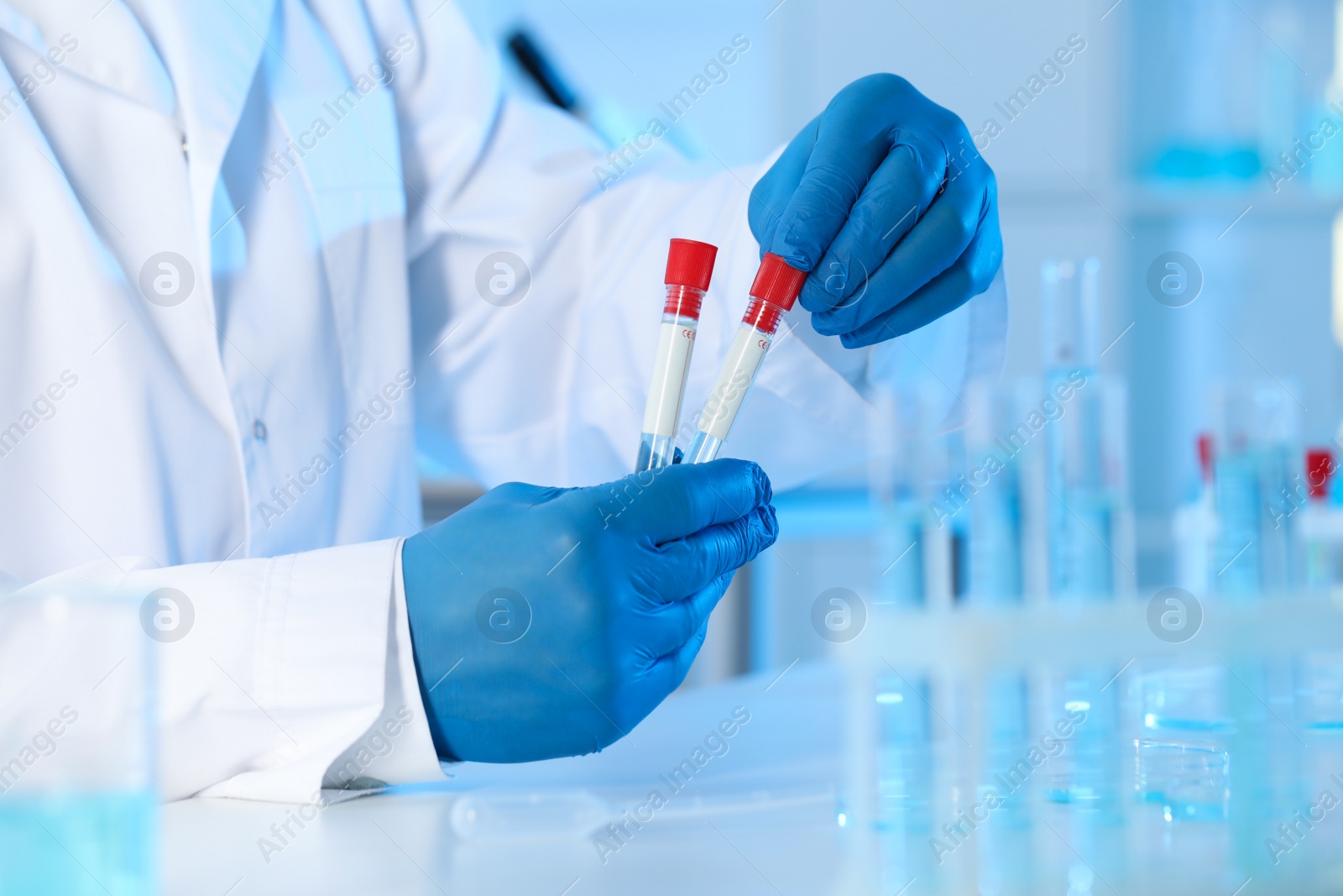 Photo of Scientist working with samples in laboratory, closeup. Medical research