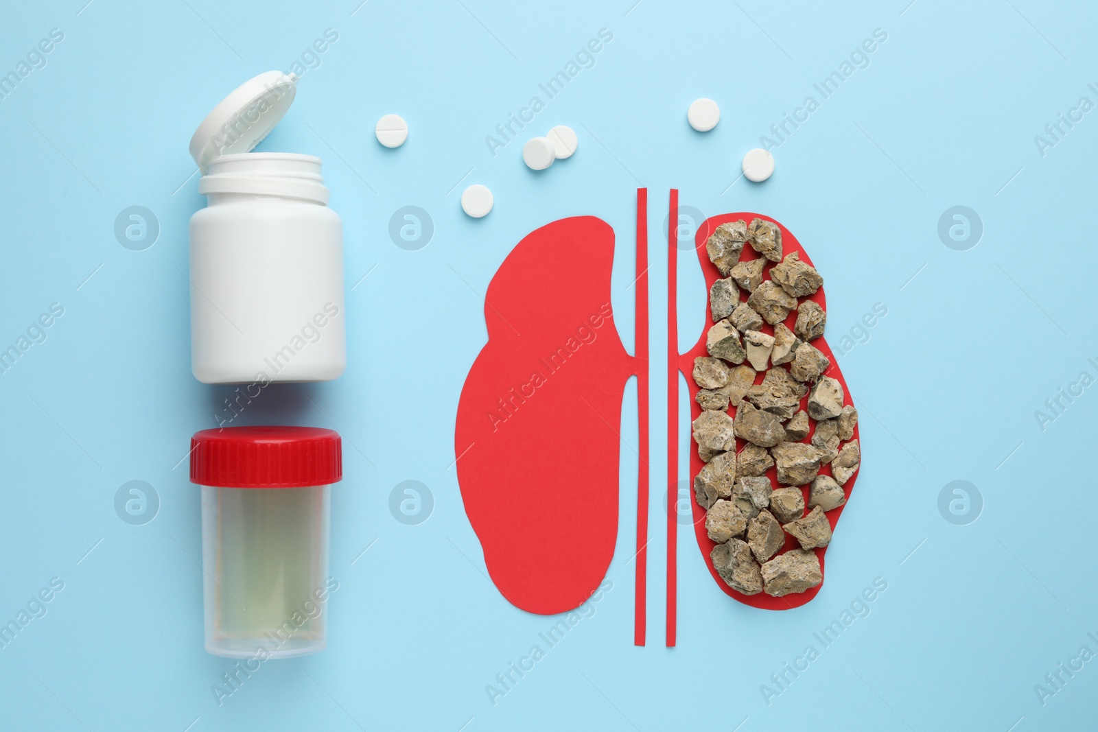 Photo of Paper cutout of kidneys with stones, pills and urine test on light blue background, flat lay