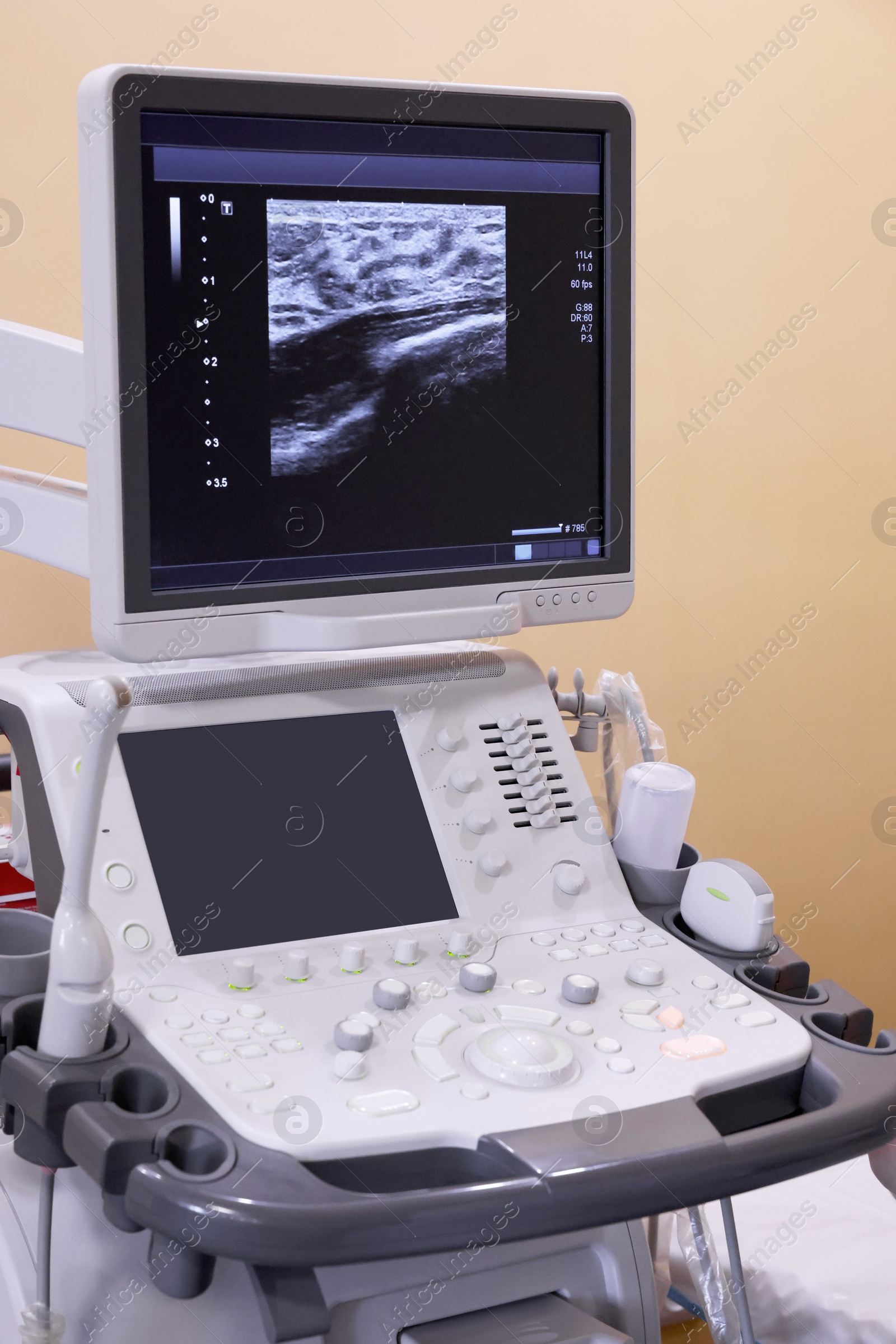 Photo of Ultrasound machine with sonogram of woman's breast on screen in hospital