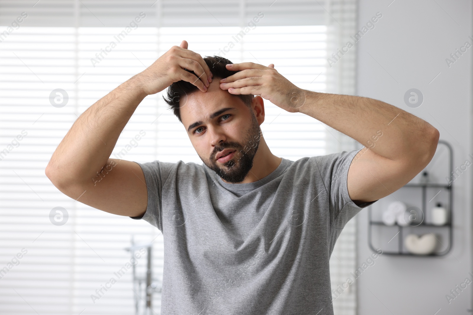 Photo of Man examining his head in bathroom. Dandruff problem