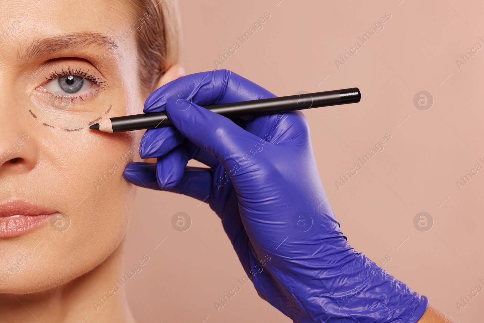 Photo of Doctor with pencil preparing patient for cosmetic surgery operation on light brown background, closeup