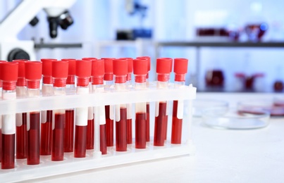 Test tubes with blood samples for analysis on table in laboratory. Space for text