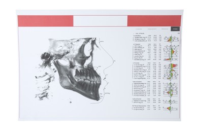 Photo of Visualization of human maxillofacial section for dental analysis printed on paper isolated on white