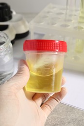 Photo of Doctor holding container with urine sample for analysis at grey table, closeup