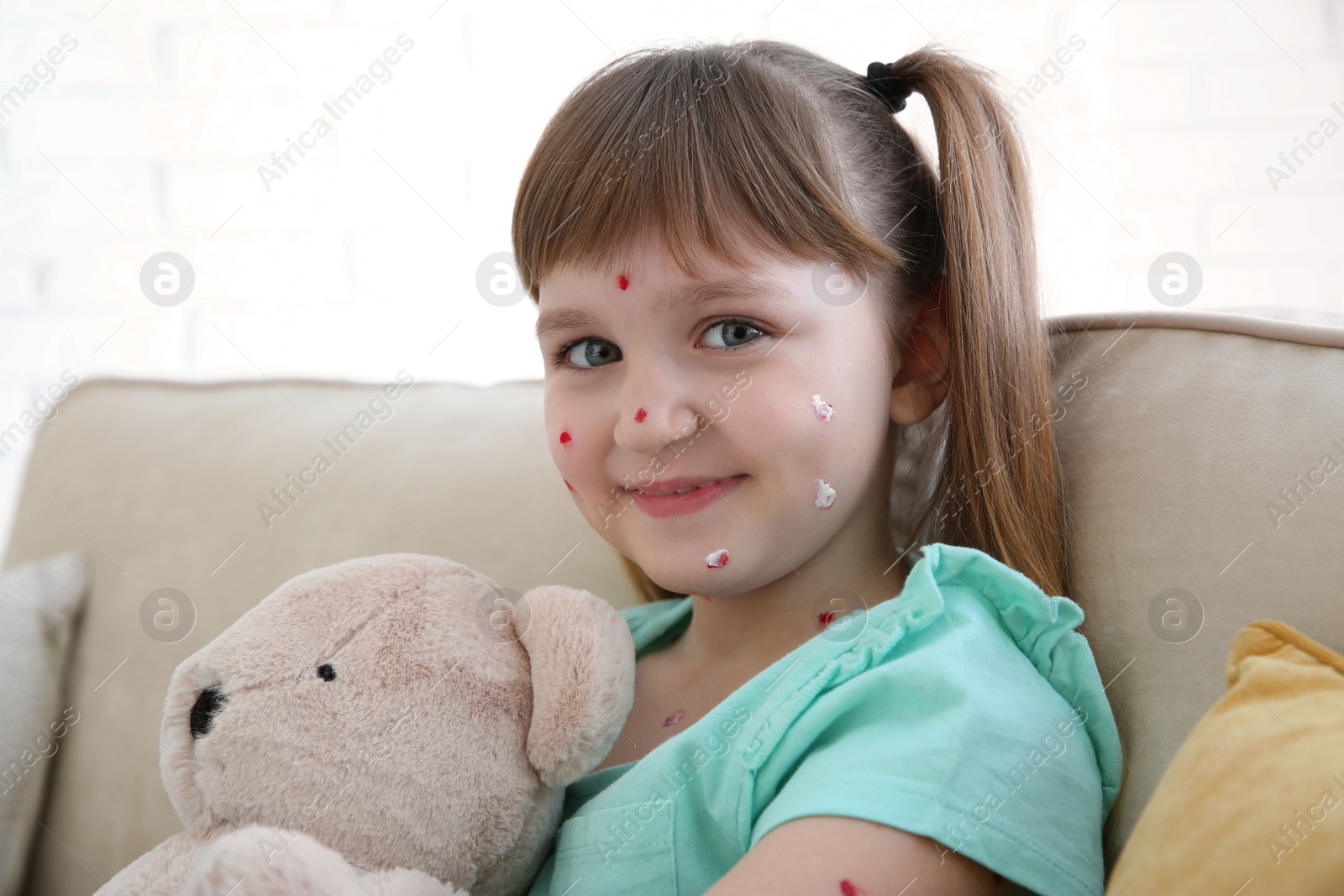 Photo of Little girl with chickenpox sitting on sofa at home