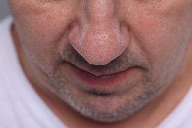 Photo of Closeup view of man with normal skin