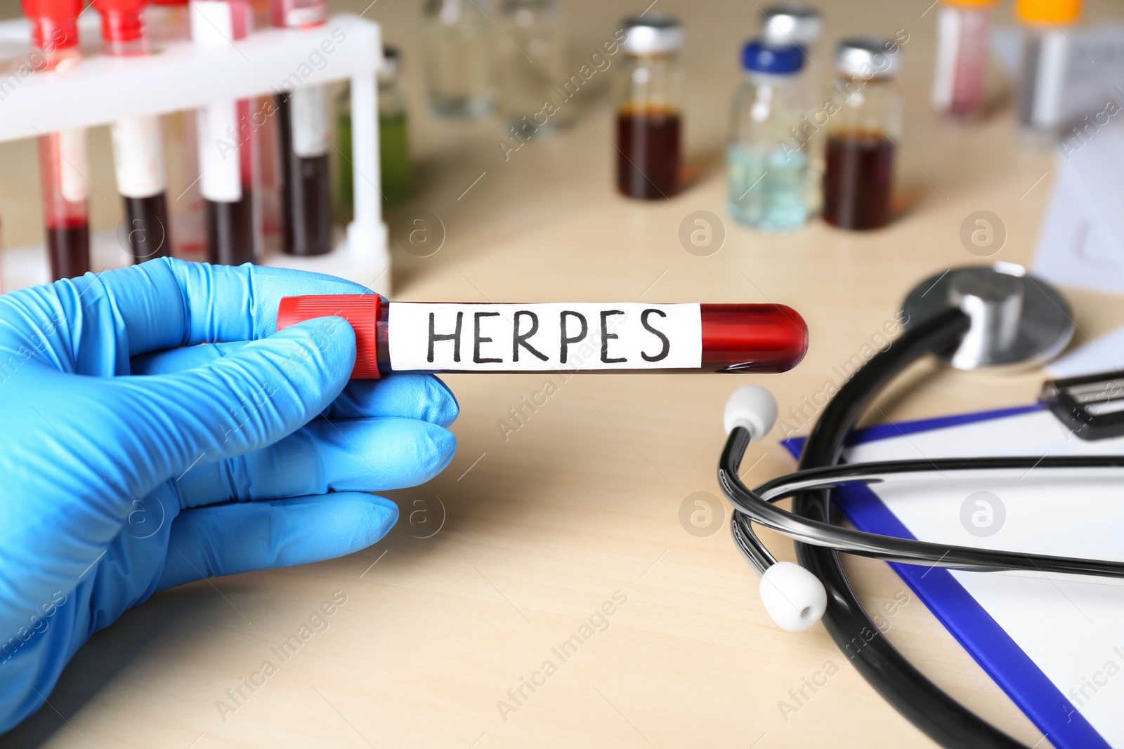 Photo of Doctor in glove holding test tube with word Herpes at wooden table, closeup