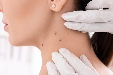 Photo of Dermatologist examining patient in clinic, closeup view