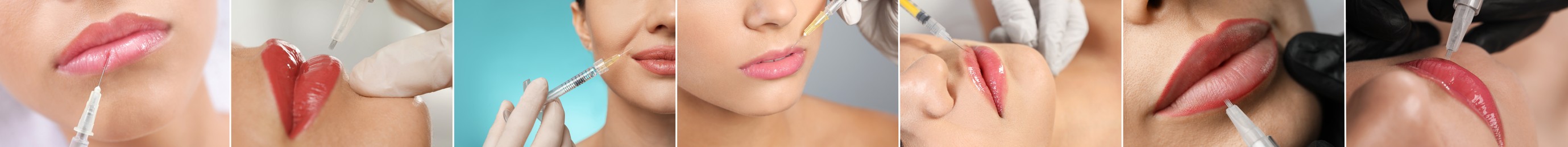 Image of Collage with photos of women during procedures of lip augmentation and permanent makeup, closeup. Banner design