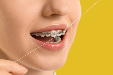 Photo of Woman with braces cleaning teeth using dental floss on yellow background, closeup