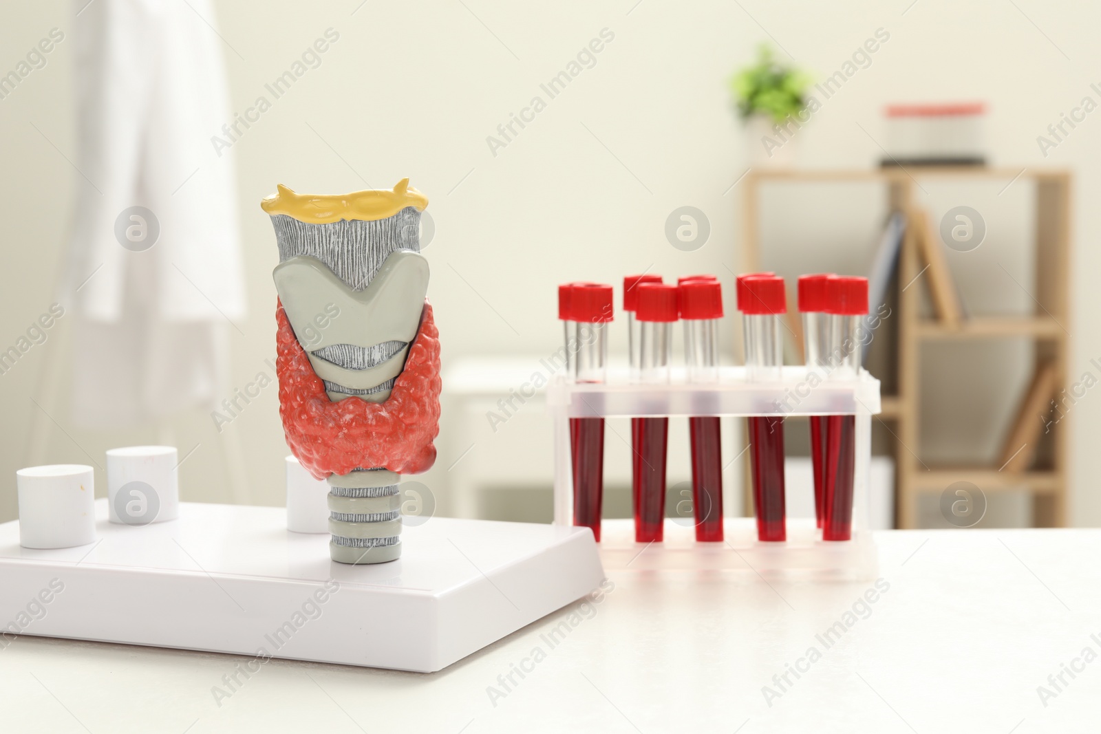 Photo of Endocrinology. Model of thyroid gland and samples of blood in test tubes on white table at clinic
