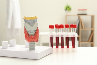 Photo of Endocrinology. Model of thyroid gland and samples of blood in test tubes on white table at clinic