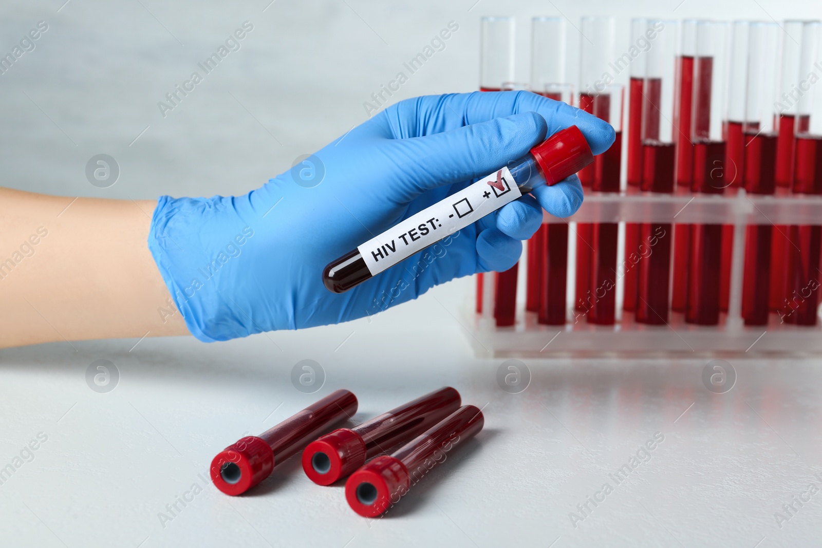 Photo of Scientist holding tube with blood sample and label HIV Test at white table, closeup