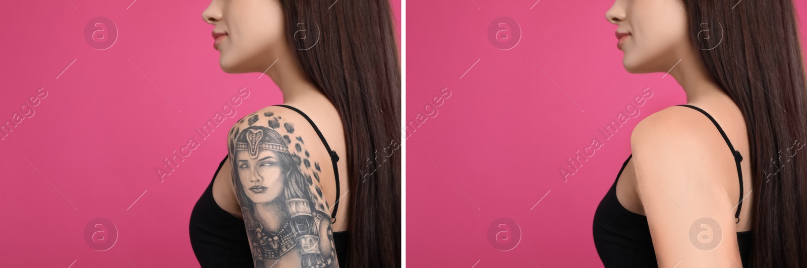 Image of Woman before and after laser tattoo removal procedure on pink background, closeup. Collage with photos, banner design