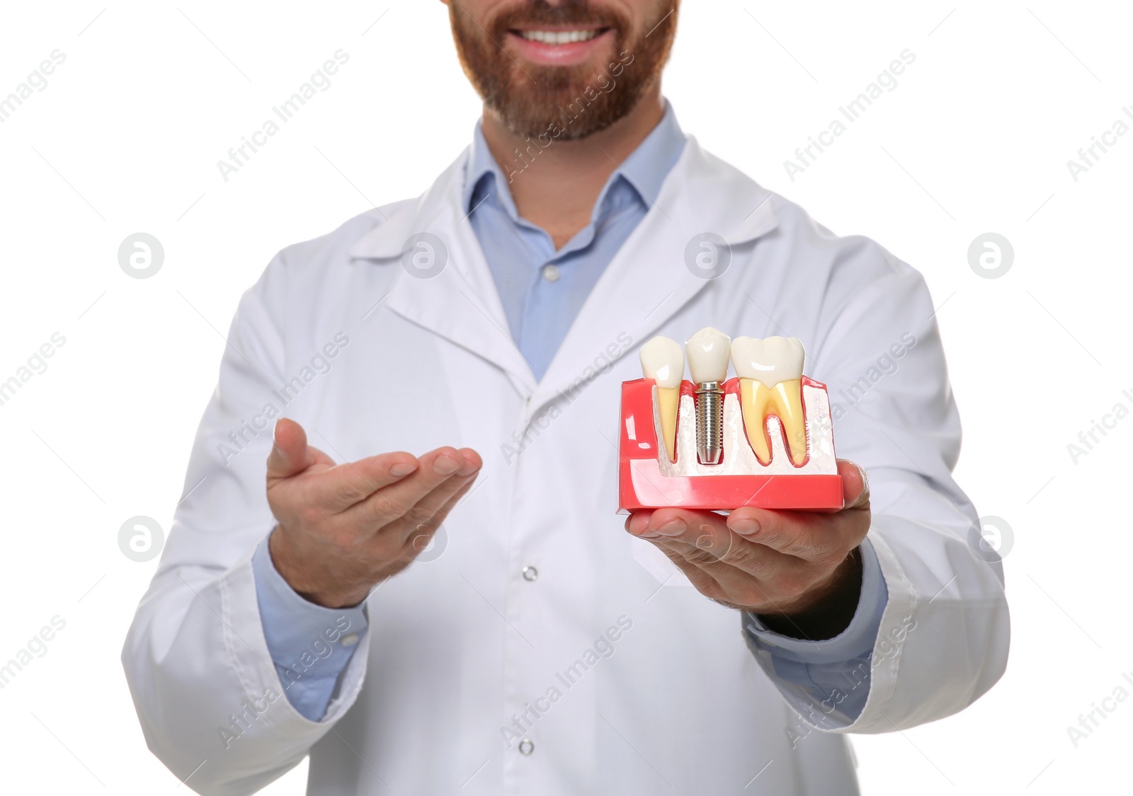 Photo of Dentist holding educational model of dental implant on white background, closeup