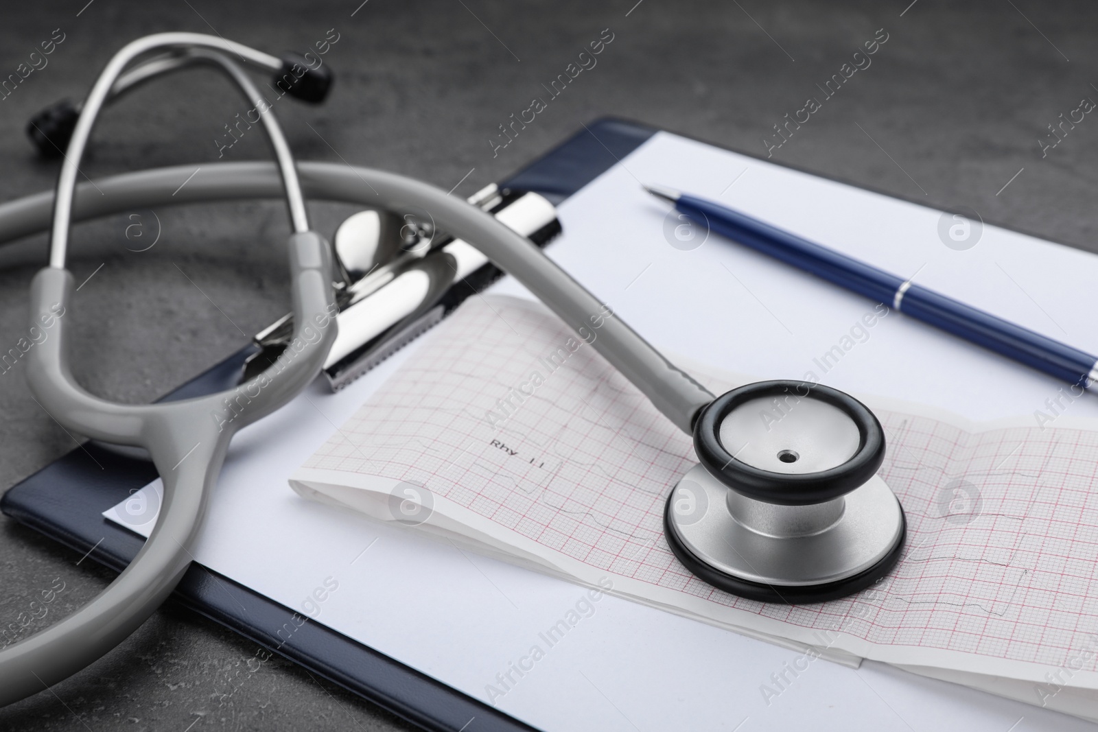 Photo of Clipboard with stethoscope and cardiogram on grey table, closeup