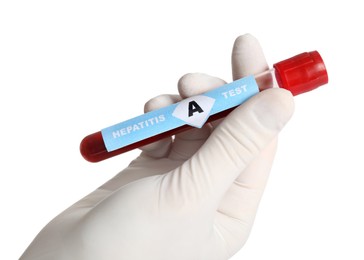 Scientist holding tube with blood sample and label Hepatitis A Test on white background, closeup