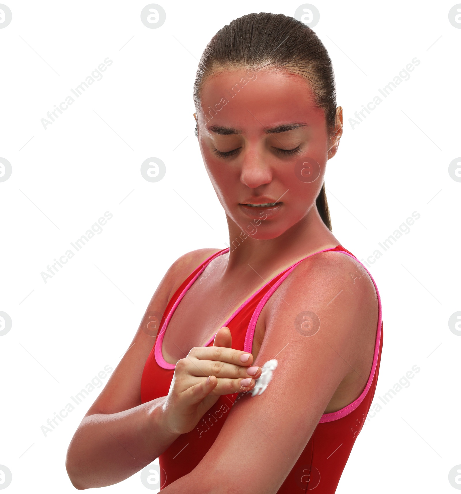 Photo of Woman applying cream on sunburn against white background