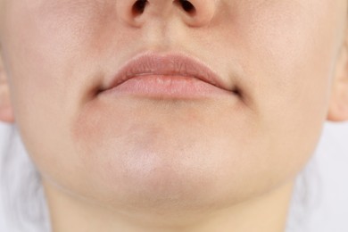 Closeup view of woman with dry skin