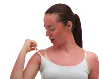 Woman with sunburned skin on white background