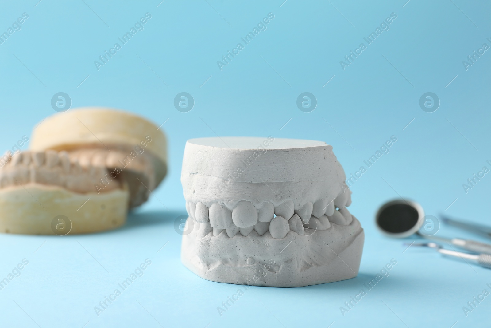 Photo of Dental model with gums on light blue background. Cast of teeth