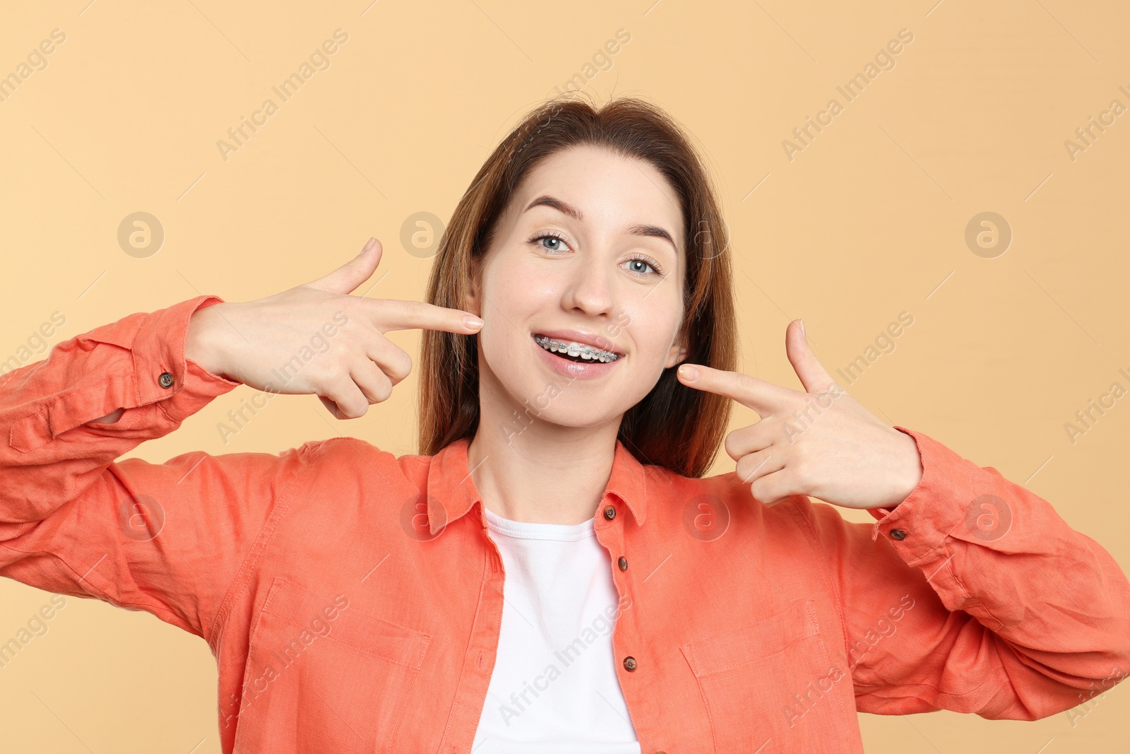 Photo of Portrait of smiling woman pointing at her dental braces on beige background