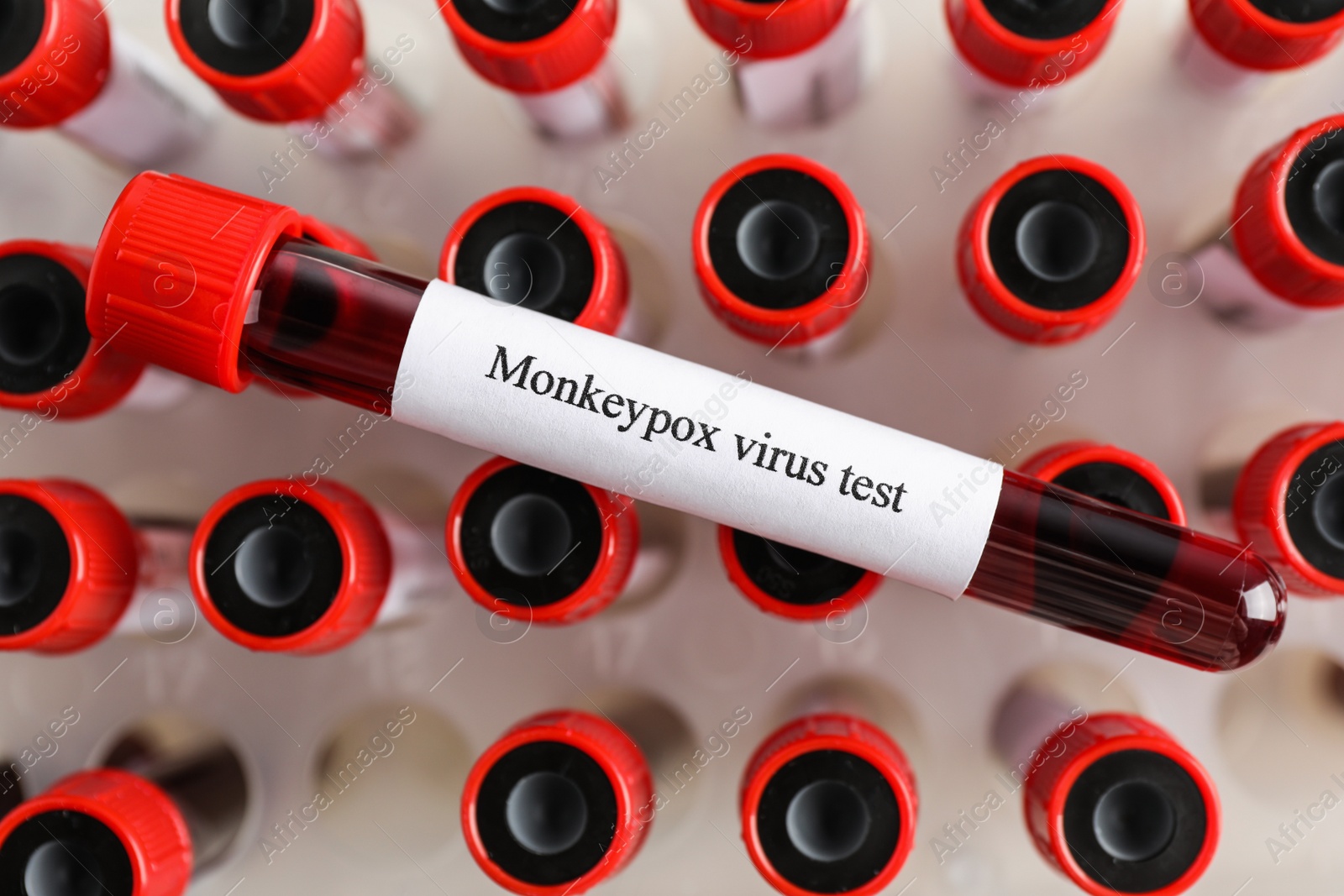 Photo of Monkeypox virus test. One sample tube with blood on others, top view