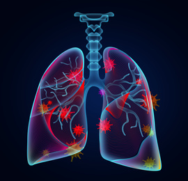 Illustration of  human lungs affected with disease on dark background