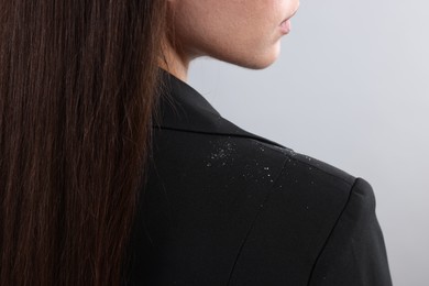 Woman with dandruff on her jacket against light grey background, closeup