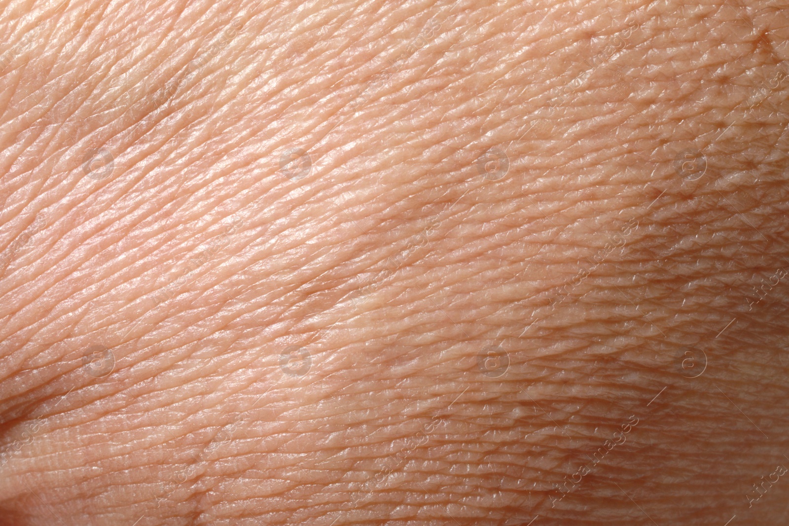 Photo of Closeup view of dry human skin as background