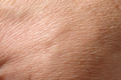 Closeup view of dry human skin as background