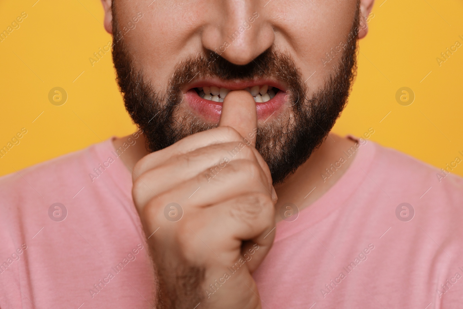 Photo of Man biting his nails on yellow background, closeup. Bad habit