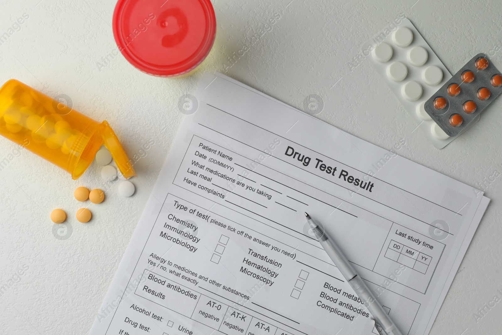 Photo of Drug test result form, container with urine sample and pills on light table, flat lay