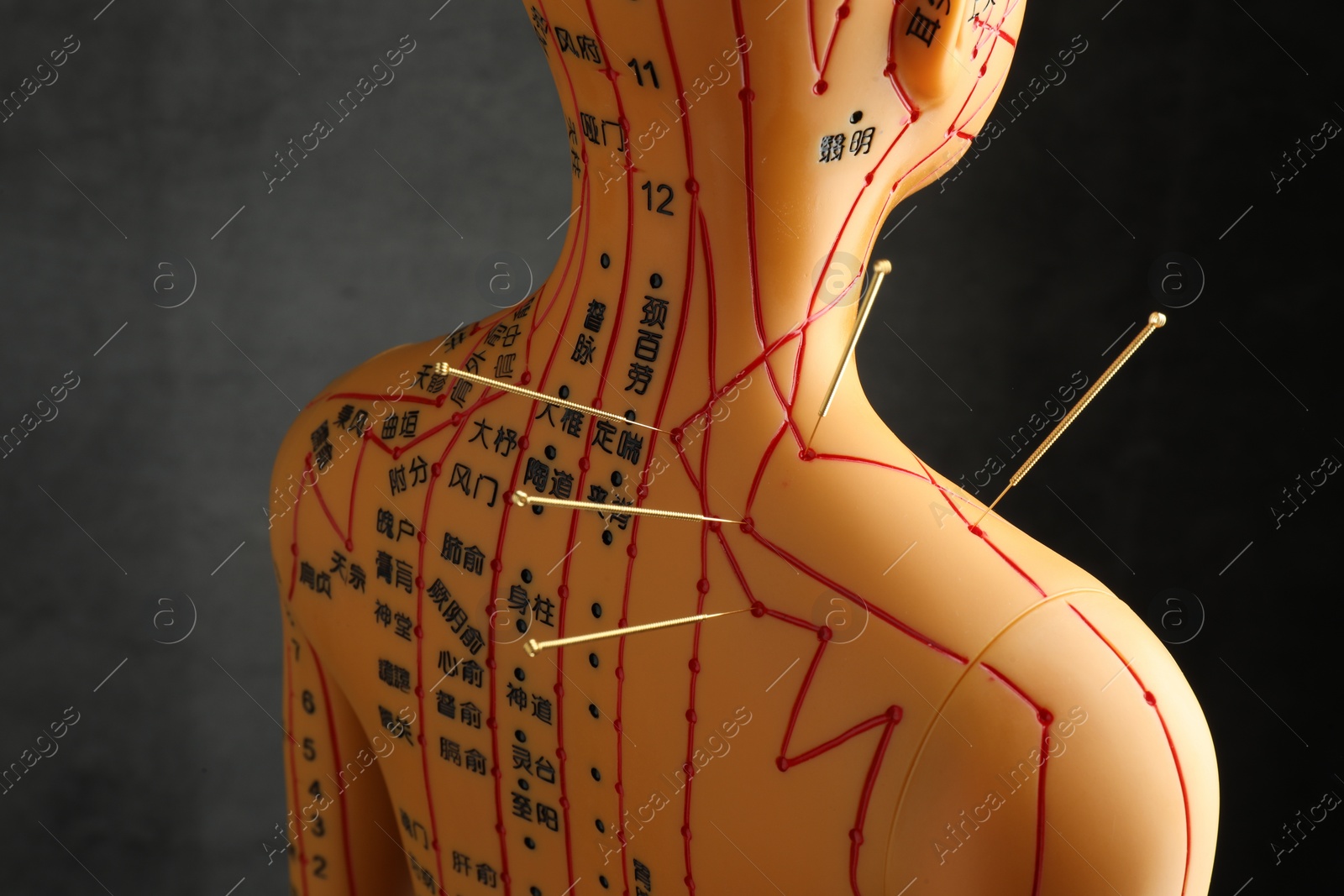 Photo of Acupuncture - alternative medicine. Human model with needles in shoulder against dark grey background