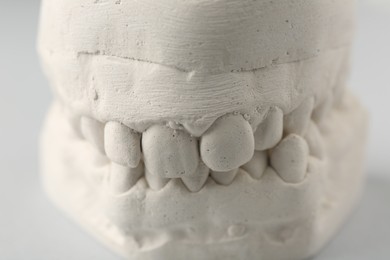 Photo of Dental model with gums on light grey background, closeup. Cast of teeth