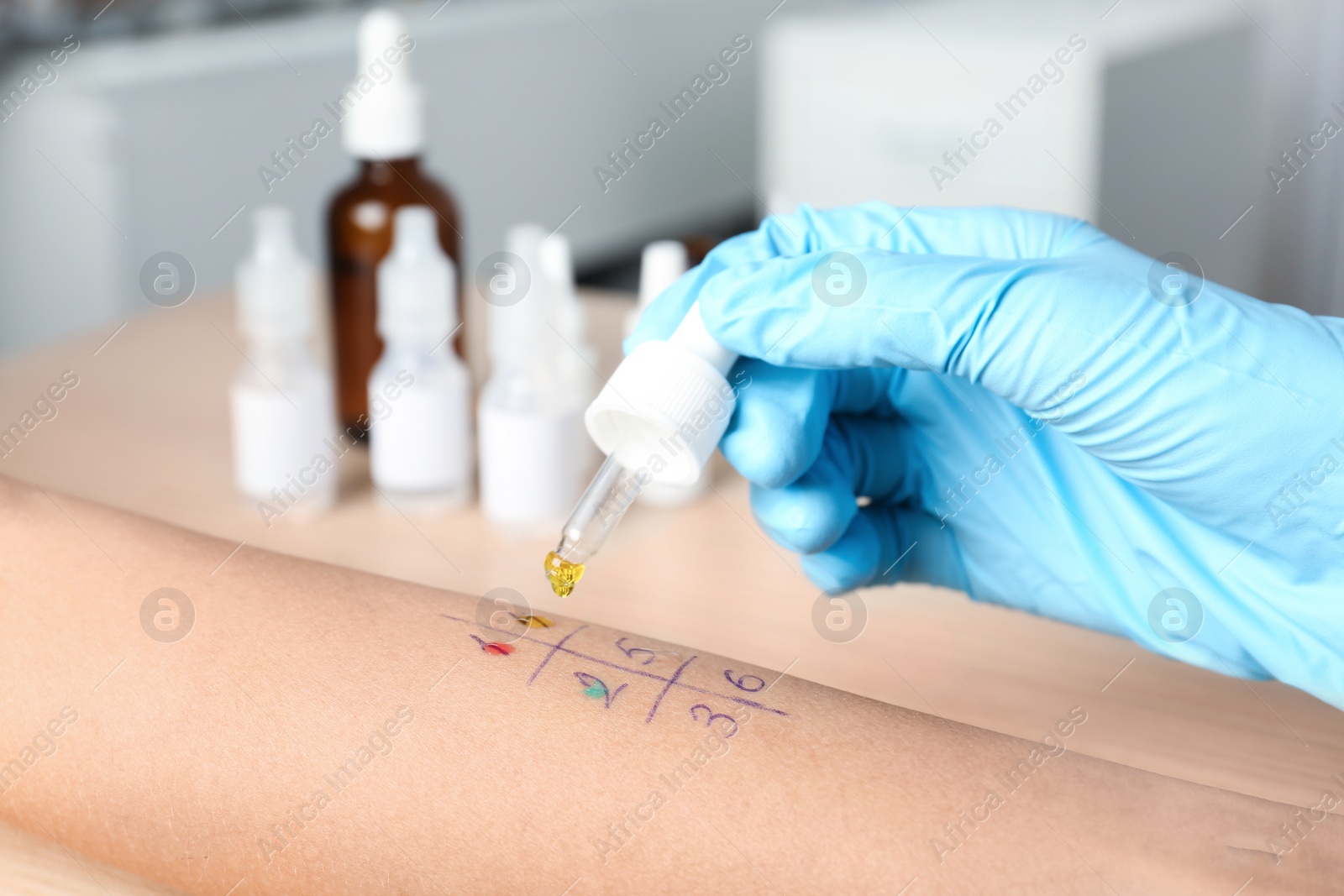 Photo of Doctor making allergy test at table, closeup