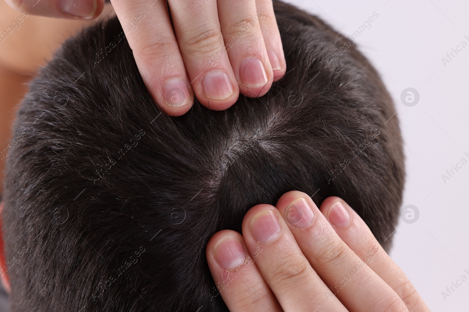 Photo of Man examining his hair and scalp on white background, closeup