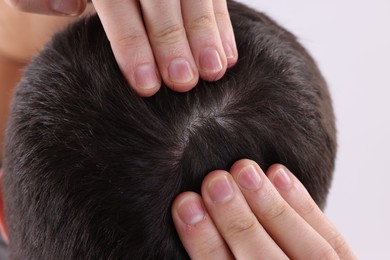 Photo of Man examining his hair and scalp on white background, closeup