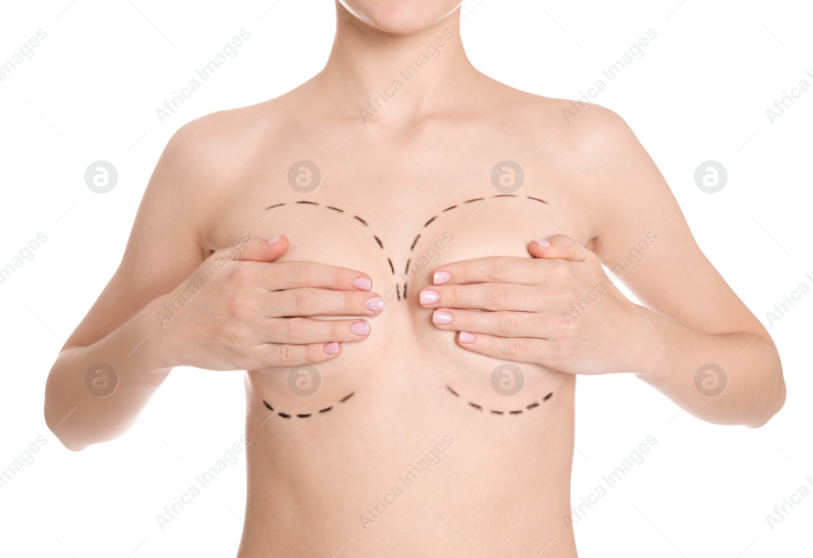 Photo of Young woman with marks on breasts for cosmetic surgery operation against white background