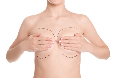 Photo of Young woman with marks on breasts for cosmetic surgery operation against white background