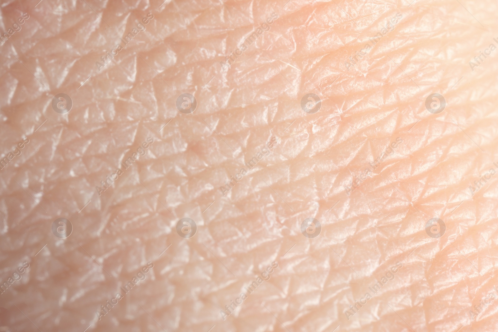 Photo of Texture of dry skin as background, macro view