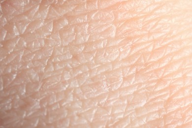 Photo of Texture of dry skin as background, macro view