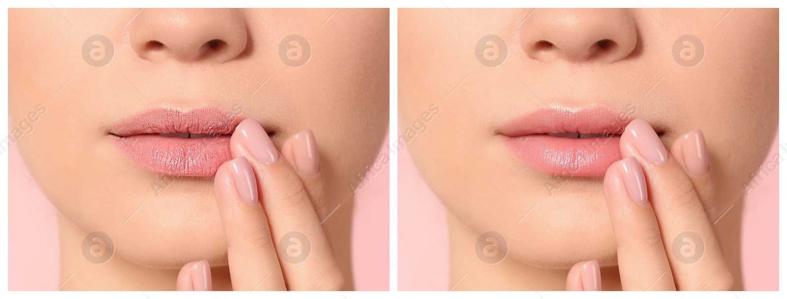 Image of Collage with photos of woman before and after using lip balm on pink background, closeup