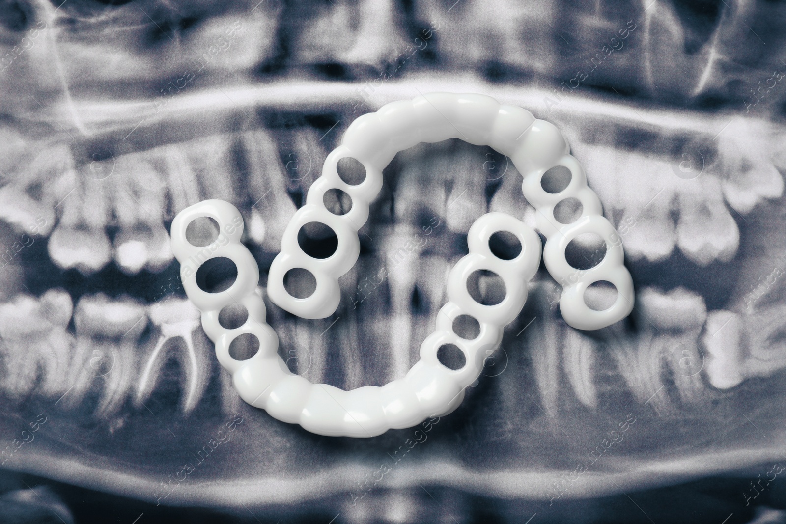 Photo of Mouth guards on dental scan, flat lay. Bite correction