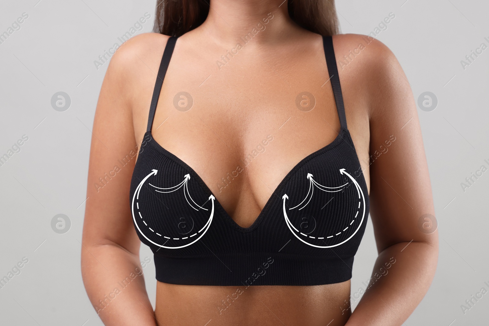 Image of Breast surgery. Woman with markings on bra against light background, closeup