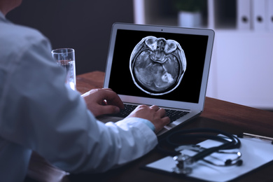 Image of Doctor examining x-ray of patient with brain cancer on laptop in clinic, closeup