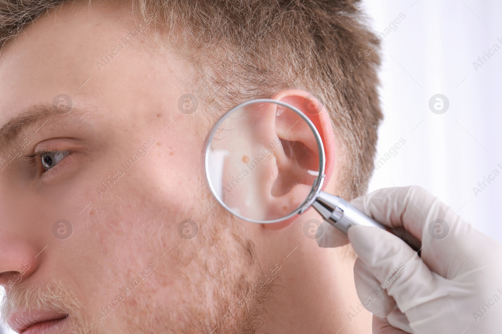 Photo of Dermatologist examining patient with magnifying glass in clinic, closeup view