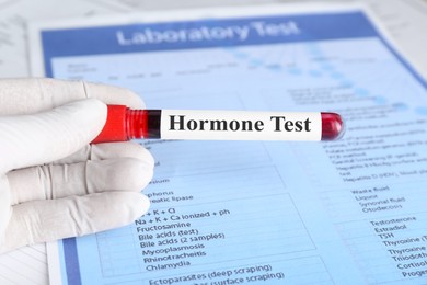 Photo of Hormones test. Scientist holding sample tube with blood against laboratory form, closeup