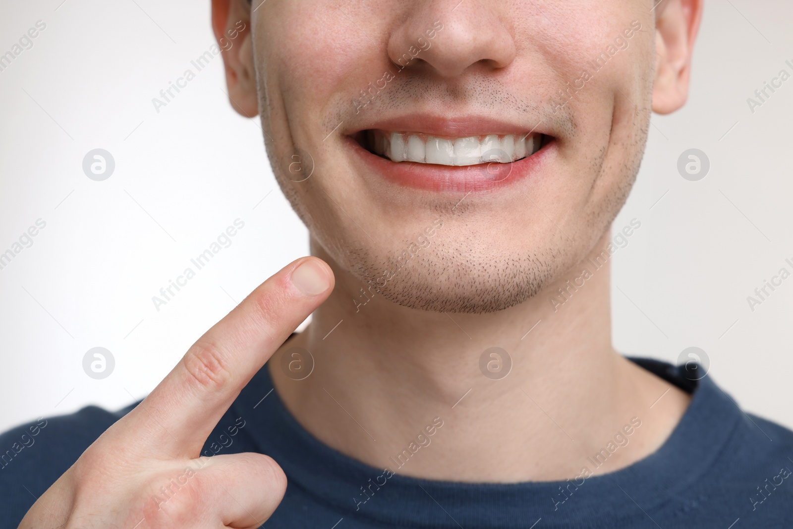 Photo of Young man showing his teeth with whitening strip on light background, closeup